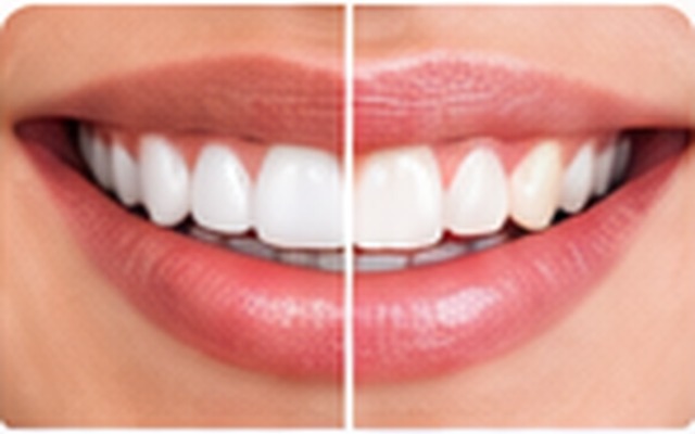 Cosmetic Dentistry