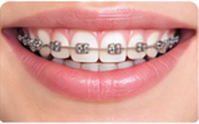 Orthodontics
